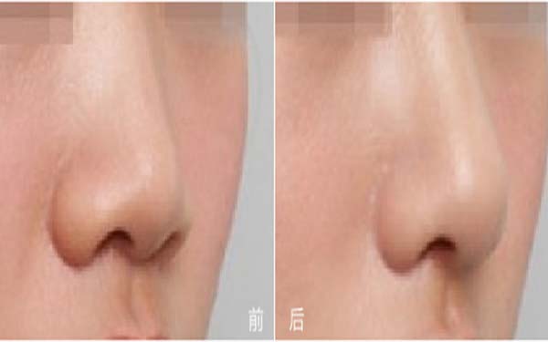 濟(jì)南市中華容高恩美容外科診所靠譜嗎？2023價(jià)格表明細(xì)一覽，值得信賴嗎？