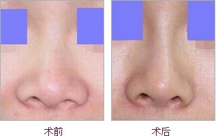 2023浙江上瞼提肌肌腱折疊矯正醫(yī)療整形醫(yī)院排名TOP10，好口碑推薦！