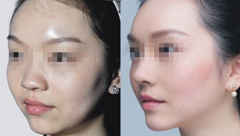 云南昆明——摯受矚目的整形醫(yī)生十佳，眾所推崇的技藝能手！
