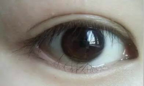 滄州鼻部整形有哪些醫(yī)院可以選擇？想要了解鼻部整形的醫(yī)院選擇？