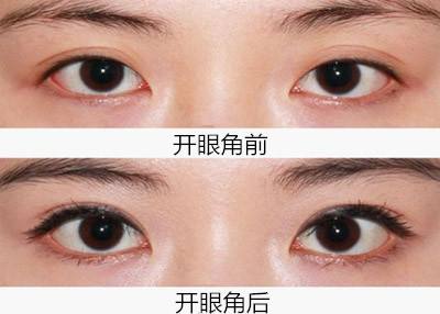 2023遼寧微針去除細(xì)紋榜單：遼寧省內(nèi)比較好的整形醫(yī)院排名展示
