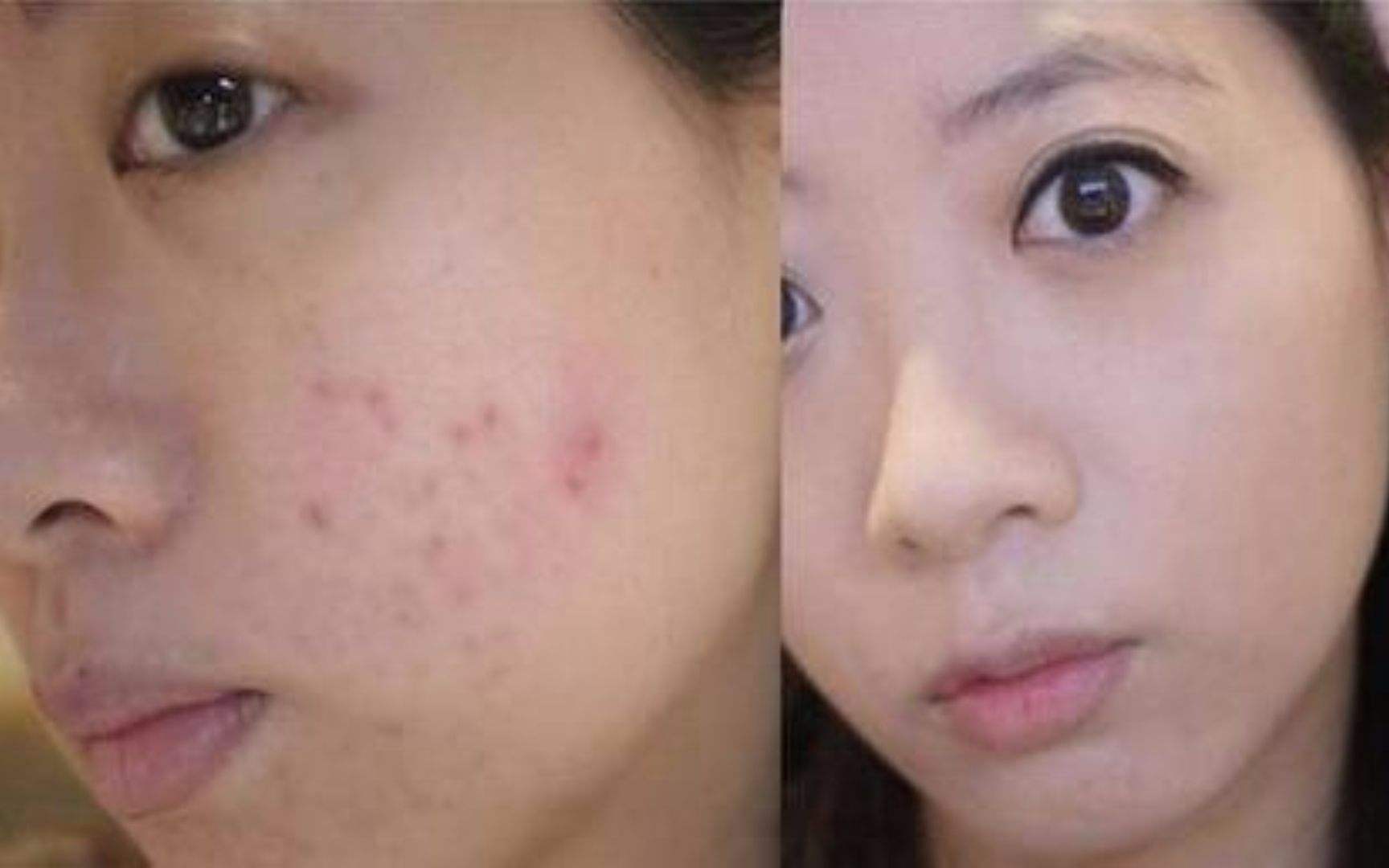 溫州地區(qū)很受歡迎的水動(dòng)力瘦臉整形醫(yī)院排名TOP10，綜合實(shí)力備受認(rèn)可！
