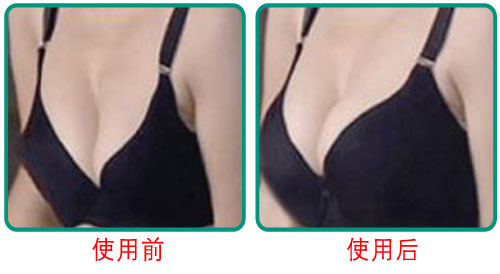 上海哪家醫(yī)院祛頸紋效果好？2023年排名前10的小切口祛頸紋醫(yī)療整形醫(yī)院推薦！