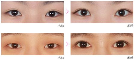 昆明整形美容醫(yī)院推薦！2023年哪家醫(yī)院去皺除皺效果好？