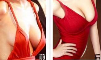 北京黃金微雕吸脂手術(shù)的醫(yī)院匯總：2023年，比較推崇的整形效果可觀的十家醫(yī)院