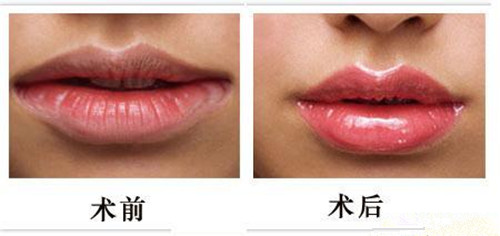 無(wú)錫哪家醫(yī)院眼底紋淡化效果比較好？2023年排名前10位的整形美容醫(yī)院推薦！