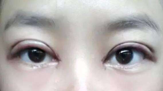 2023年南京排名前十的大腿溶脂針醫(yī)療美容醫(yī)院評比