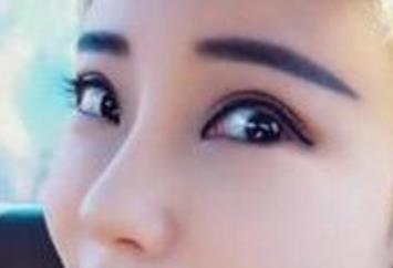 2023年莆田細胞激光去川字紋醫(yī)療美容醫(yī)院十大整形效果一覽