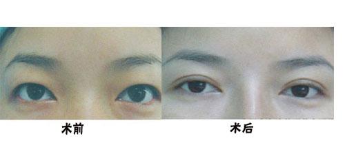 珠海市疤痕修復(fù)手術(shù)醫(yī)療美容醫(yī)院排行榜及口碑推薦