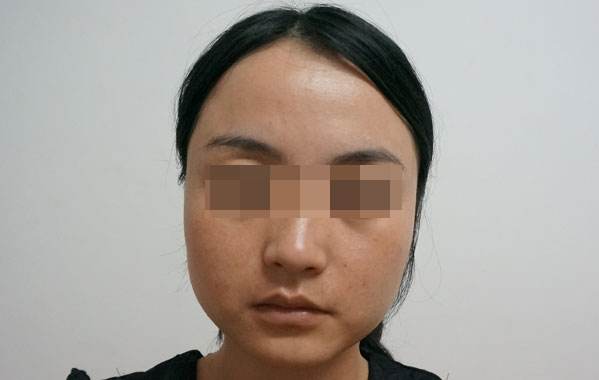 懷化哪家整形醫(yī)院的整形價(jià)格更實(shí)惠？2023更新整形費(fèi)用曝光了嗎？
