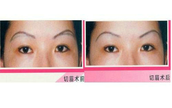 上海哪家眼角去痣醫(yī)療美容醫(yī)院更專業(yè)？2023年排名前10的實(shí)力口碑整形美容醫(yī)院！