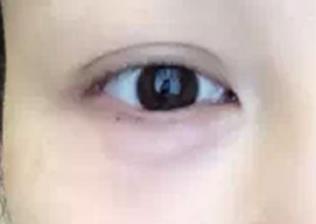 2023年天津上瞼凸嘴手術(shù)醫(yī)院排名前十實地考察，推薦度高的有哪些？