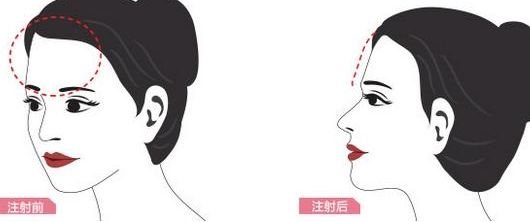 善方醫(yī)院吸脂收費(fèi)高嗎？擁有哪些收費(fèi)項(xiàng)目？