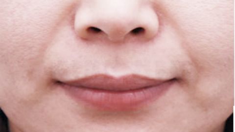 湖南人民醫(yī)院整形科的專家醫(yī)生有哪些？價格如何呢？
