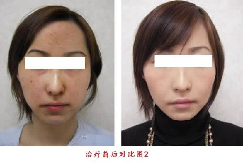 重慶哪些醫(yī)療美容醫(yī)院提供耳垂畸形矯正服務(wù)？2023年的前10家受歡迎醫(yī)院推薦！