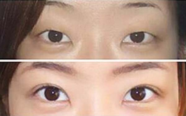 大連川字紋填充嗨體整形醫(yī)院評(píng)價(jià)如何？2023年大連川字紋填充嗨體知名美容醫(yī)院口碑名單發(fā)布！