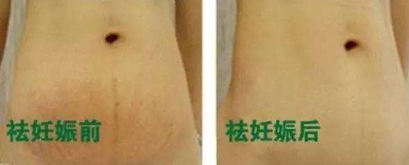 南京靜晟熙醫(yī)療美容診所到底好不好？服務(wù)質(zhì)量如何？價格有競爭力嗎？