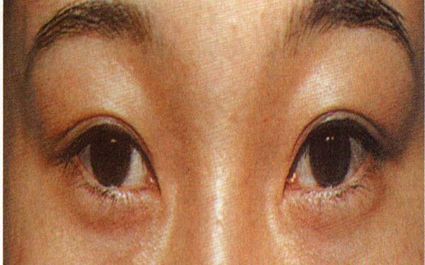 邯鄲治療青春痘的彩光嫩膚權(quán)威整形美容醫(yī)院排行榜