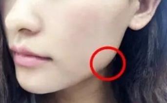2023年哈爾濱著名手術(shù)去除抬頭紋醫(yī)療美容醫(yī)院盛名彰顯！尋找十家正規(guī)醫(yī)院，一網(wǎng)打盡！