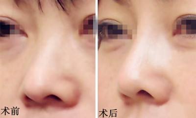 無錫去頸紋整形醫(yī)院排行榜2023年重磅發(fā)布！清單top10醫(yī)美機(jī)構(gòu)揭曉