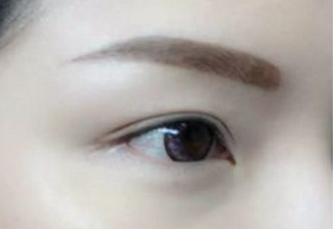 北京哪家醫(yī)院做鼻部整形效果好？權(quán)威醫(yī)院推薦！擁有高挺鼻梁，獲得完美鼻型參考！