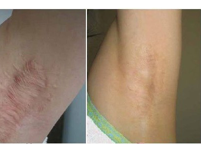 上海比華利醫(yī)療美容整形醫(yī)院口碑如何？有哪些備受推崇的醫(yī)生？