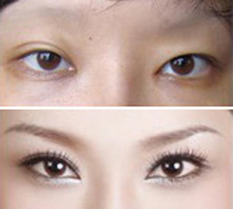 揭秘2023深圳優(yōu)質(zhì)面部提升微創(chuàng)手術(shù)醫(yī)院，美譽度口碑一流