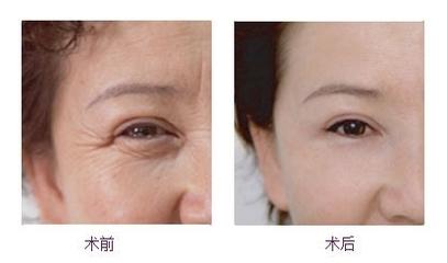 2023年寧波有哪些值得推薦的祛斑醫(yī)院？