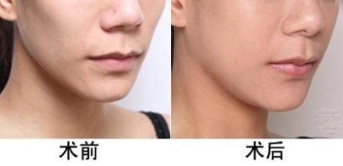 揭秘北京雙眼皮修復大咖！這5位獨具匠心的專家一定讓你驚艷！