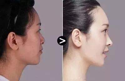 【2023】汕頭妊娠紋處理十強醫(yī)院盤點！汕頭哪里有好評如潮的玻尿酸祛妊娠紋專業(yè)醫(yī)院？