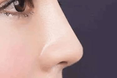 深圳美萊醫(yī)院的雙眼皮手術(shù)是否有效？梁曉健、郭杰、黃凱醫(yī)生解析優(yōu)勢！