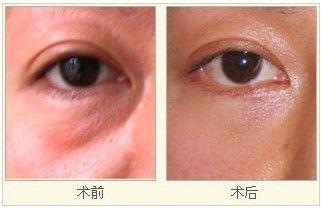周口地區(qū)哪家醫(yī)院是專業(yè)的鼻部整形美容醫(yī)院？2023年鼻部整形排名前10強(qiáng)醫(yī)院提前揭曉！