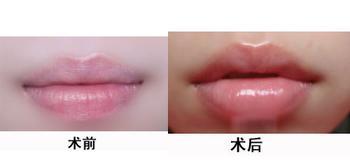 南京哪些醫(yī)療美容醫(yī)院口碑好，線雕祛眼周紋效果？TOP10榜單揭曉！