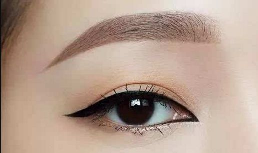 上海眼王的羅文婷醫(yī)生雙眼皮效果如何？價格怎么樣？