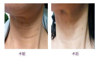 沈陽注射伊維蘭去皺整形醫(yī)院哪家好？2023沈陽伊維蘭去皺專業(yè)醫(yī)院評價比較好！
