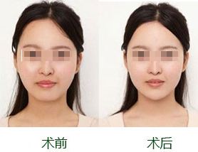 2023岳陽(yáng)哪些醫(yī)院值得去進(jìn)行法令紋填充，榜單前10強(qiáng)實(shí)力評(píng)點(diǎn)！