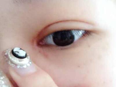 北京愛悅麗格馬力修復(fù)眼睛真的有效嗎？眼袋無影蹤？