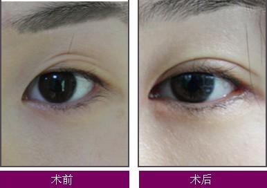 2023年南京生物鼻整形醫(yī)療，權(quán)威排行榜前十強名單公布！不容錯過的專業(yè)醫(yī)院揭秘！