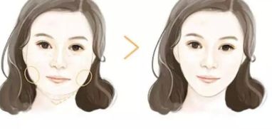 無(wú)錫蘇亞美胸：融合精湛技術(shù)與定制美學(xué)