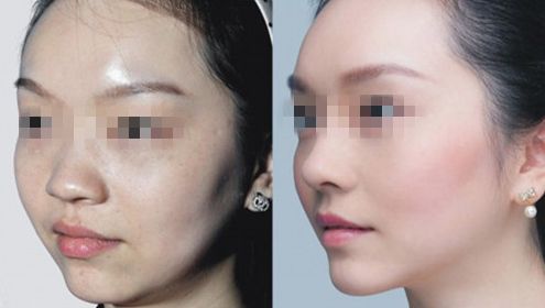 杭州整形醫(yī)院全解析：特色項目和評價大揭秘