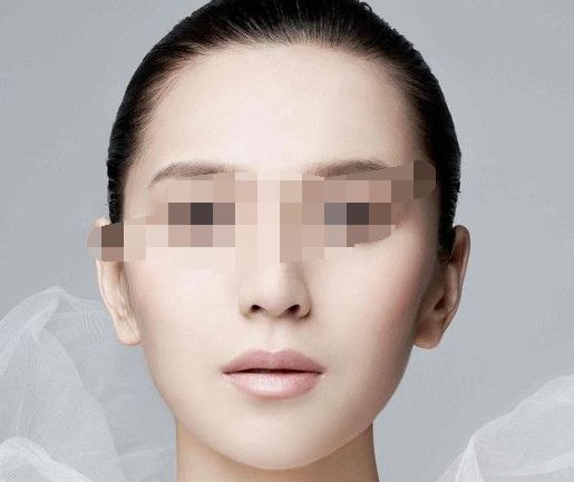 眼瞼下至手術全體驗：親身經(jīng)歷揭秘術后恢復和效果