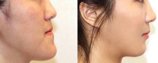 杭州華廈眼科醫(yī)院：評價與收費解析，是私立還是公辦？