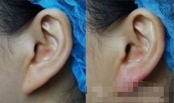腦袋提升手術(shù)：韓國明星級(jí)專家、上海專業(yè)團(tuán)隊(duì)悉心打造