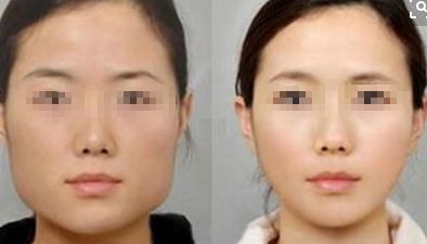 商丘市交通醫(yī)院整形美容中心：解答你的整形疑問，案例剖析助您決策
