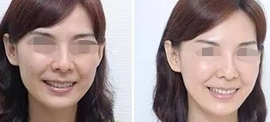 上海浦東治療狐臭的?？漆t(yī)院排名