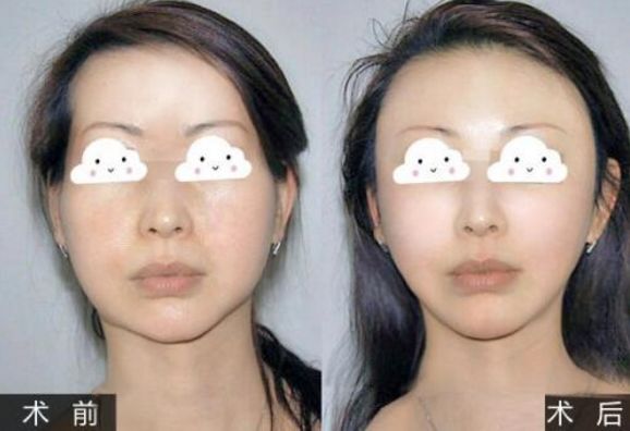 貴州省人民醫(yī)院雙眼皮術(shù)：好評如潮的整形醫(yī)生榜單