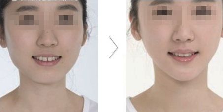 南昌治狐臭?？漆t(yī)院推薦