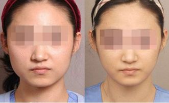 四川治療狐臭專科醫(yī)院推薦