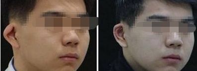 張家界治療狐臭哪家醫(yī)院好