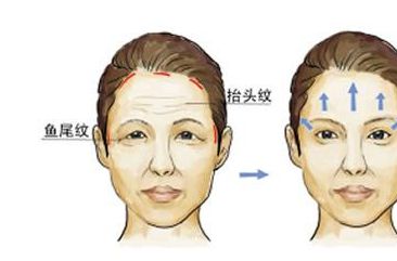 深圳假體豐臀哪家醫(yī)院好？盤點(diǎn)九大醫(yī)美大牌！